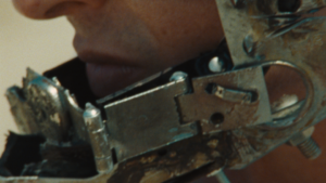 Close up of metal on person's jaw.
