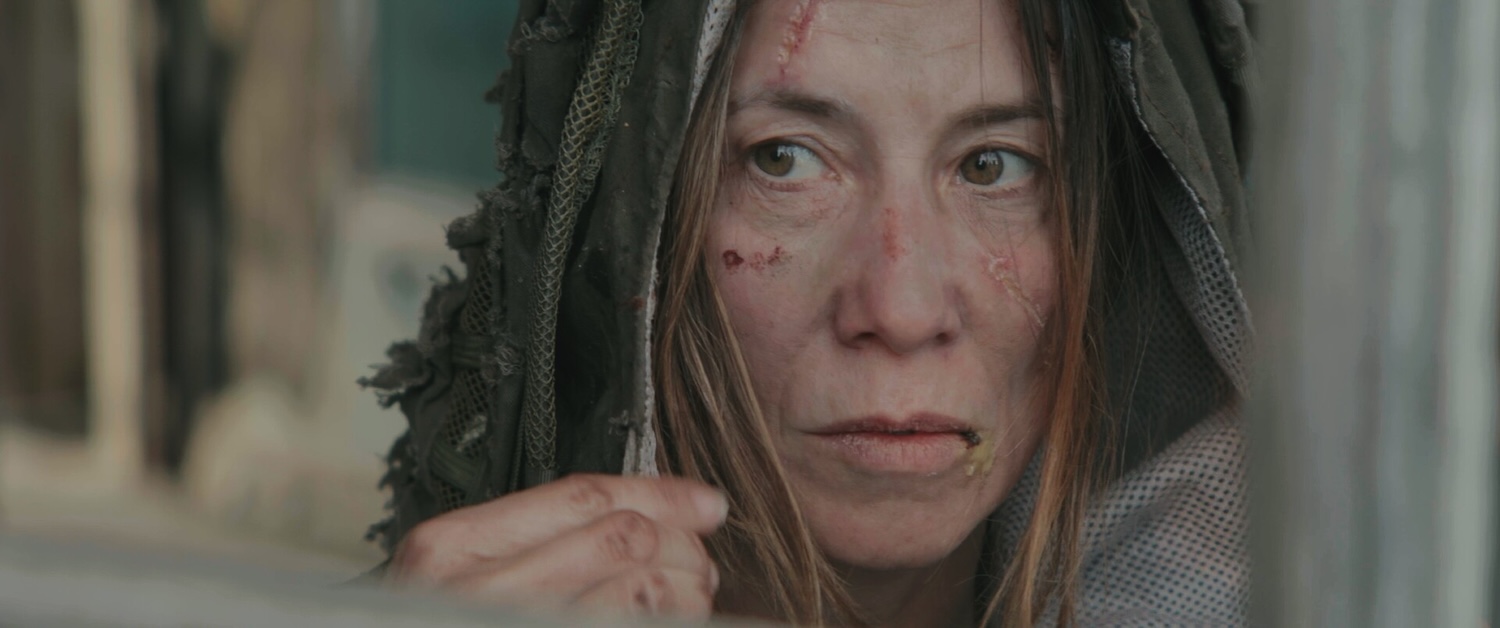 Image of person close up with scars on face.