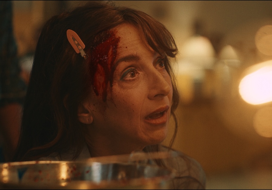 Image of a person with a barrette and blood on their head looking right.